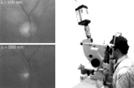 Reflectance Oximetry Measurement by M. Crittin